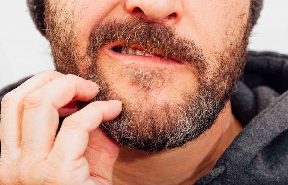 Solutions pour la barbe qui gratte